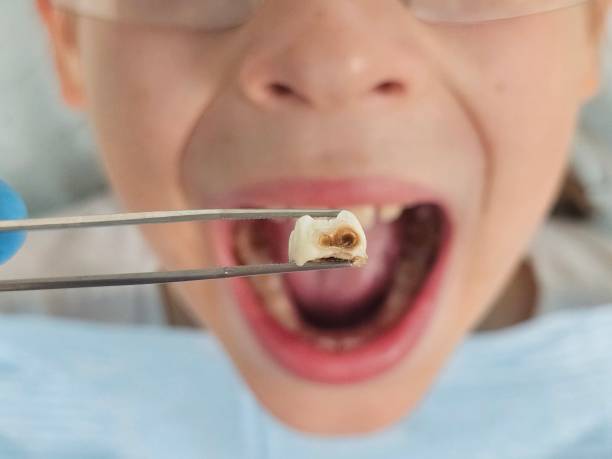 Trusted VA Emergency Dental Service Experts